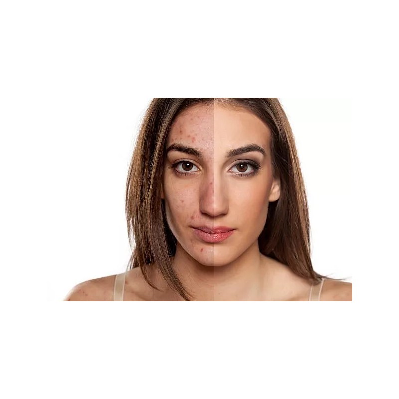 A3 Lemon Face Cream | Brightening & Control Stubborn Blemishes|400