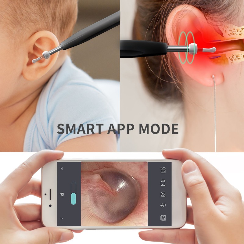 Ear Cleaner Smart Wireless Earwax Removal Tools HD Endoscope with