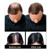 Mokasi Sevich 25gr. Bote Fibras Capilares Calvicie Cabello