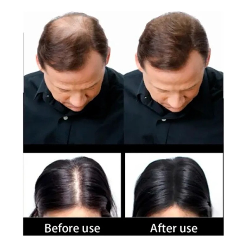 Mokasi Sevich 25gr. Bote Fibras Capilares Calvicie Cabello