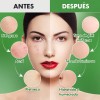 Mascarilla Jelly Hidroplástica Anti Edad