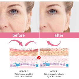 5 In 1 Vitamin C Serum For Face, Firming Skin And Even Skin Tone, with Hyaluronic Acid Serum, Vitamin E & Collagen, Vitamin C, Nicotinamide, Suitable for All Skin 1.1 fl oz (30 ml)