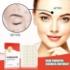 ! Set De 144 Parches Faciales Hidrocoloides Espinillas Hx