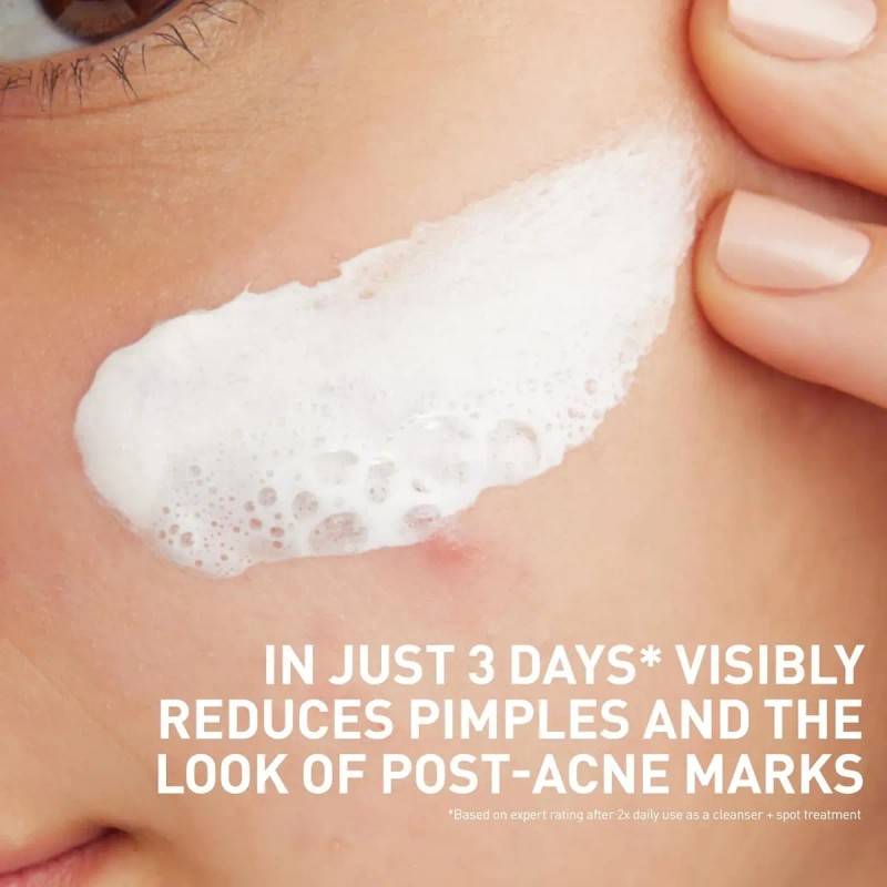 Cerave Limpiador Facial Acné 118 Ml