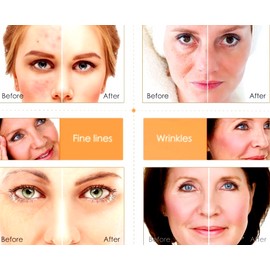 Neutrogena Vitamin C & Hyaluronic Acid Anti-Aging Serum Anti Aging Cream Face ,Eye Wrinkle