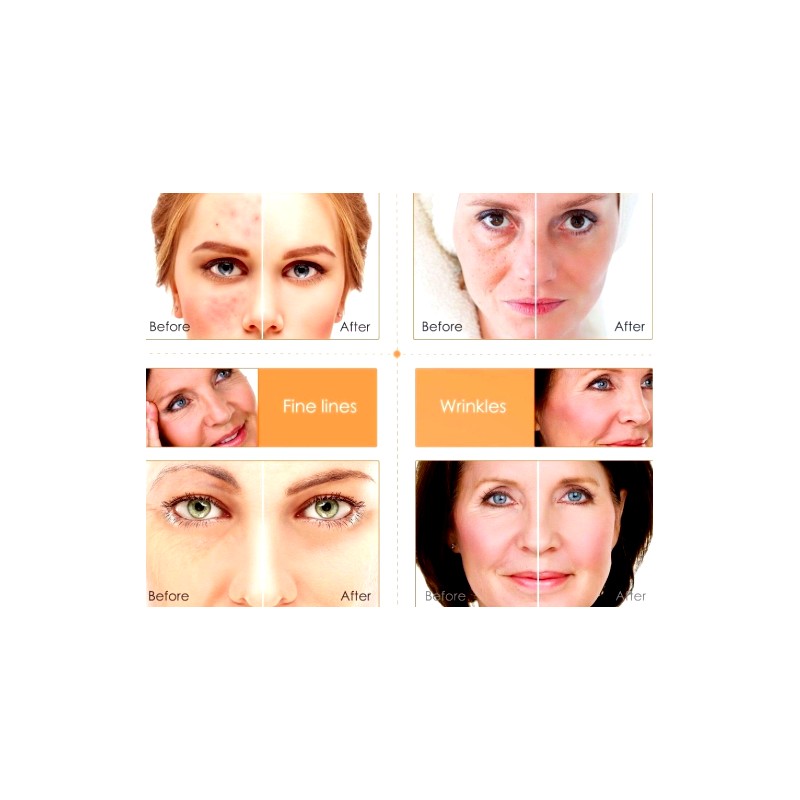 Neutrogena Vitamin C & Hyaluronic Acid Anti-Aging Serum Anti Aging