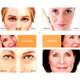 Neutrogena Vitamin C & Hyaluronic Acid Anti-Aging Serum Anti Aging Cream Face ,Eye Wrinkle