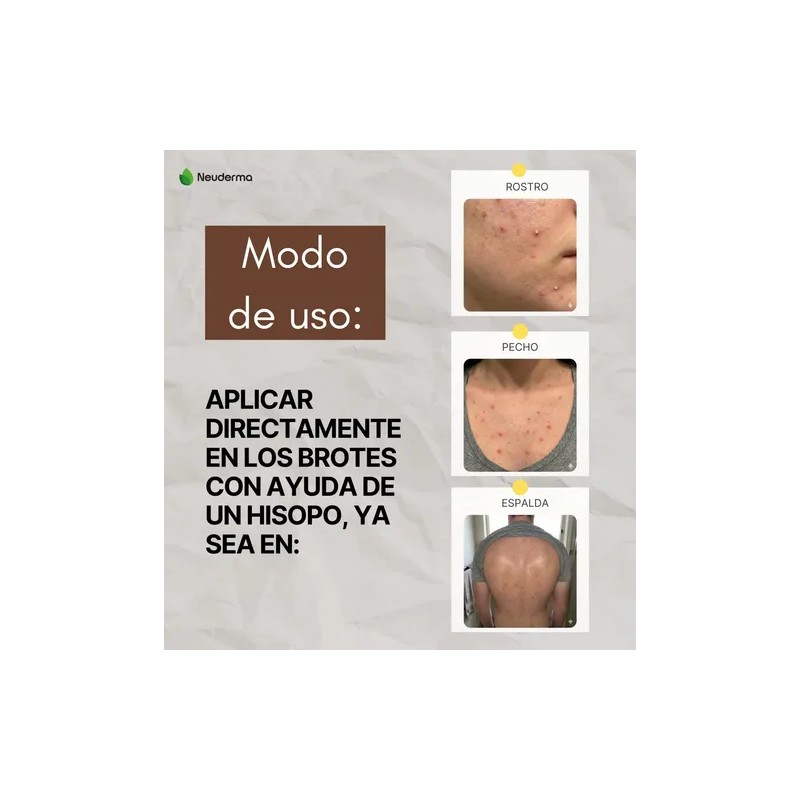 Bálsamo Antiacné Natural 60ml Árbol De Té Y Tepezcohuite