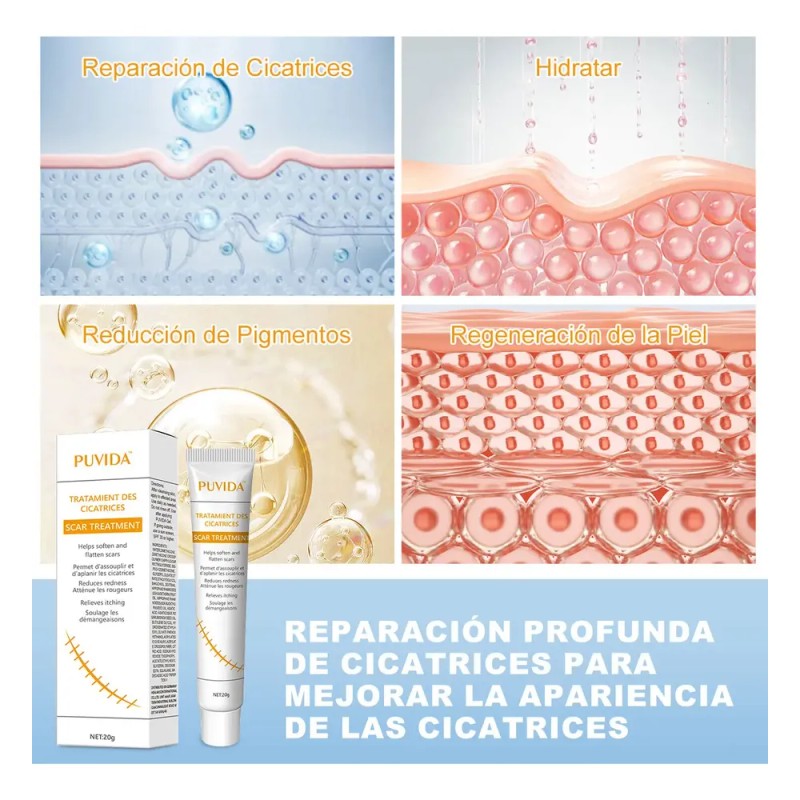 Crema Cicatricial De Minimizar Y Reducir Las Cicatrices 20g