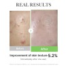 Jy Facial Coreano Jy Hidratante Y Relajante Essence