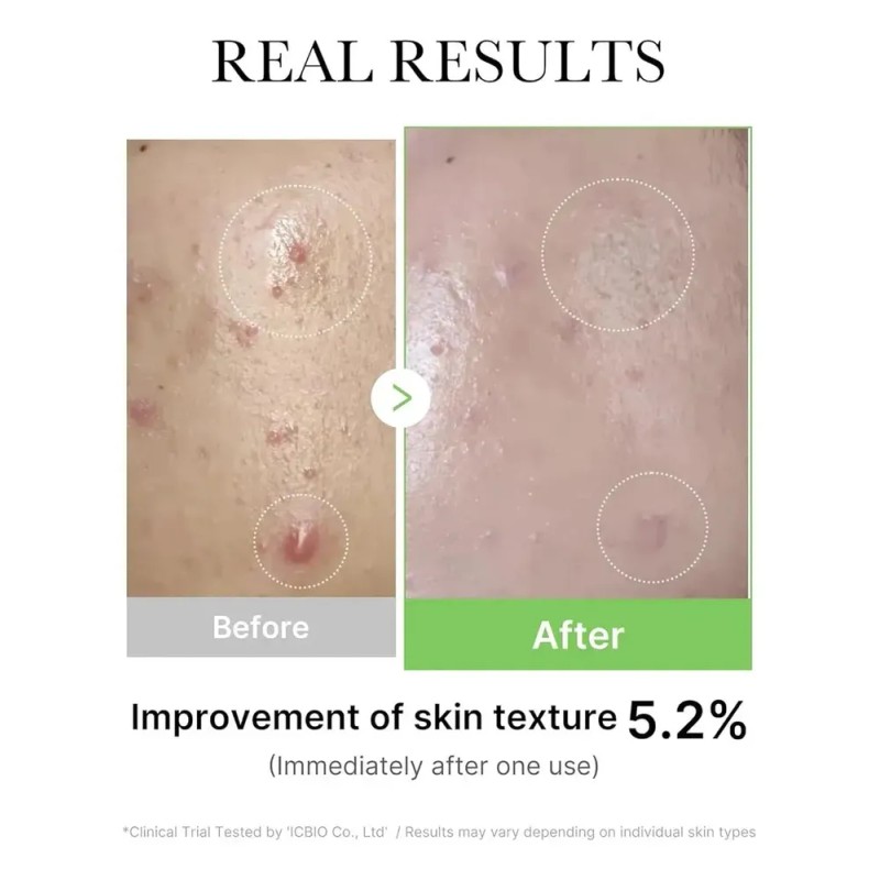 Jy Facial Coreano Jy Hidratante Y Relajante Essence