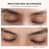 B-lashes Suero Crecimiento Pestañas Largas Origen Natural
