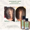 ican London Rosemary Mint Scalp & Hair Treatment Oil For