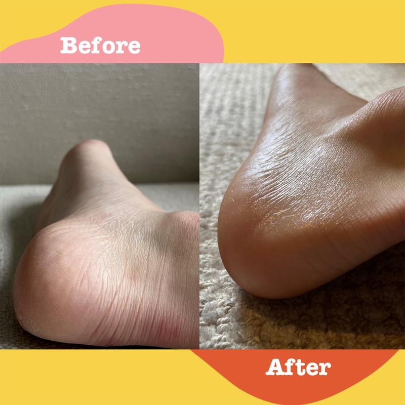 APTO Soothing Ointment w/Turmeric & Calendula: Ultra-Moisturizing Barrier Cream for