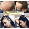 XXL Premium Hair Thickening Hair Trading Bros Magic Hair Fibres