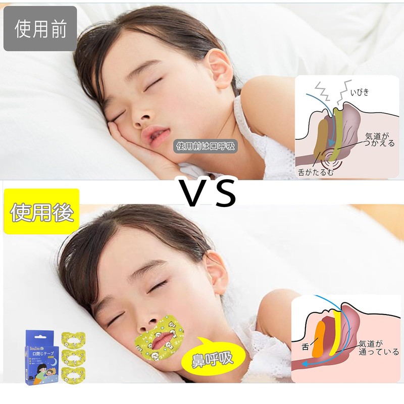 口閉じテープ 口呼吸防止テープ 鼻呼吸テープ アデノイド顔貌避け 喉の乾燥防止 鼻呼吸促進 口臭を改善する 睡眠改善 口呼吸対策 口テープ