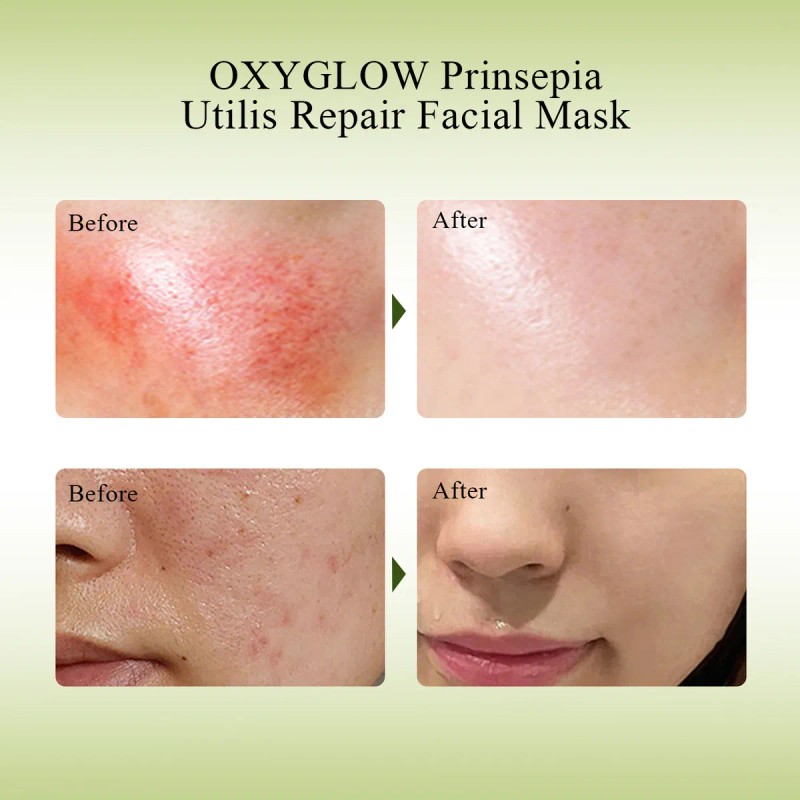 Mascarilla Facial Reparadora Aceite Prinsepia
