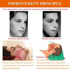 Anti Snore Chin Strap, Chin Strap for Snoring, Chin Strap for Sleeping, CPAP Chin Strap to Keep Mouth Closed While Sleeping, Adjustable & Breathable Chin Strap for CPAP User (Blue)