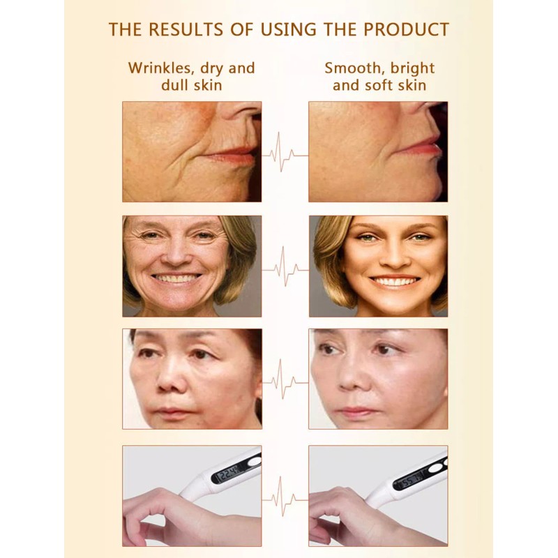 Aichun Beauty Gold Caviar Peel off Mask Face Rejuvenation Moisturizing