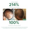Kreyol Essence - Save Our Scalp Serum (S.O.S Serum) -