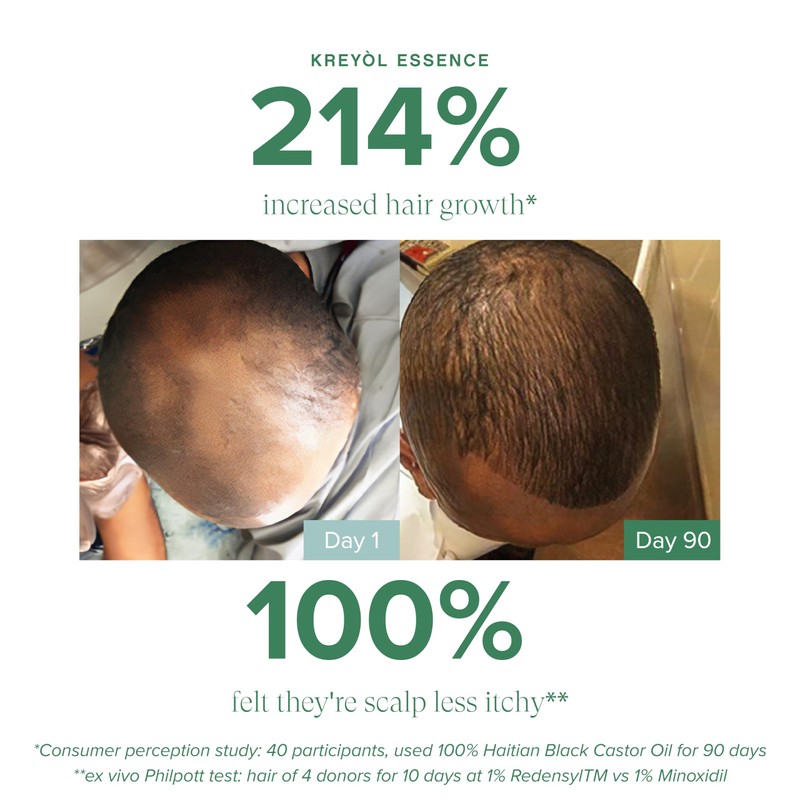 Kreyol Essence - Save Our Scalp Serum (S.O.S Serum) -