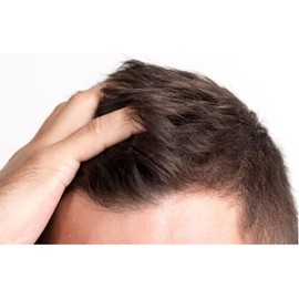 Loci?n Capilar 7%, Con Biotina