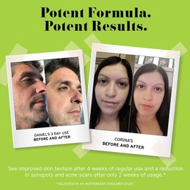 No BS Caffeine Eye Cream with Pure Hyaluronic Acid and Plant-Based Squalane Oil. Coffee Bean Under Eye Cream for Dark Circles and Puffiness. Includes a free skincare sample.