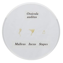 3B Scientific E13 Life Size Auditory Ossicles Model