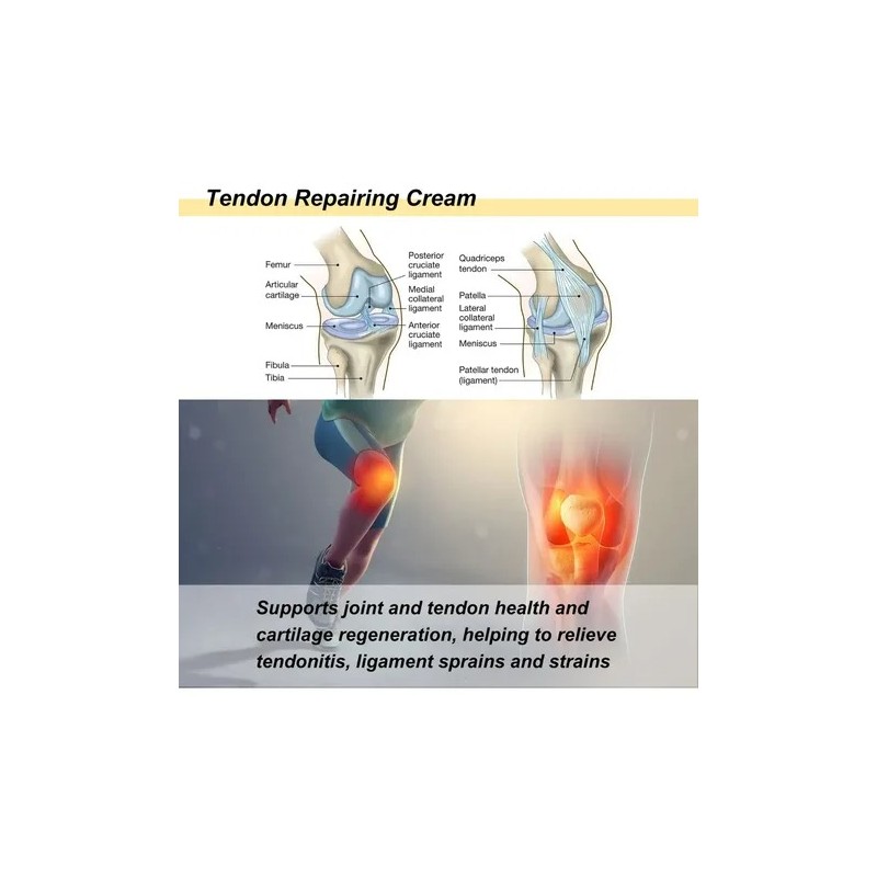 Crema Para El Cuidado De Tendones De Manos Y Pies