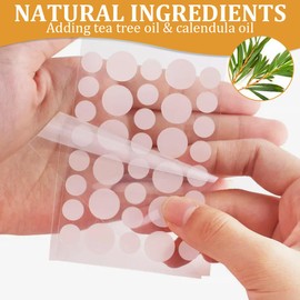 Pimple Patches, 8 Patches, Pack of 288 Pimple Patches, Invisible Hydrocolloid Patches, Anti-Acne Patches, Acne Treatment for Day & Night, for Pimple Healing, Transparent