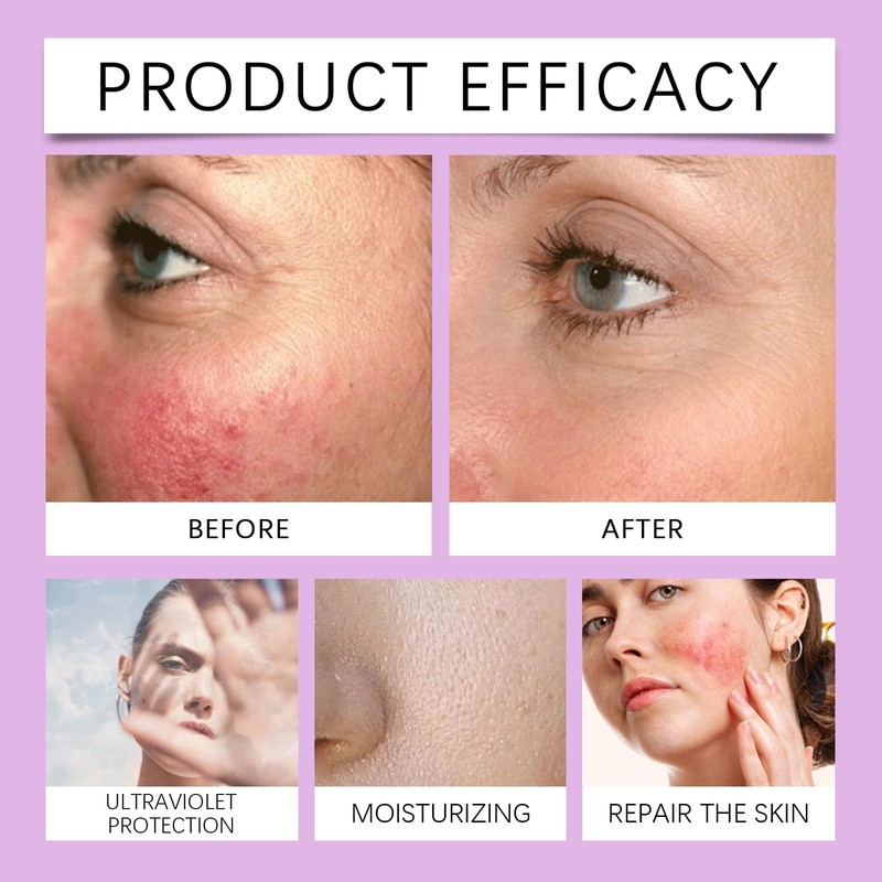 SPF 100 Sunscreen - Spf 100 Sunscreen - Uvb/Uva High