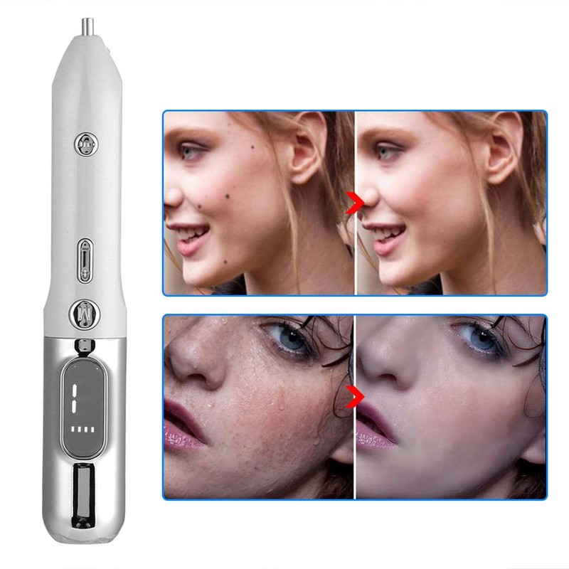 Household Face Mole Removal Pen Dark Spots Plaques Remover Skin