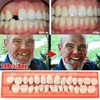 Kuashidai 28 Pieces/Set Resin Teeth Model Durable Dentures Universal Resi