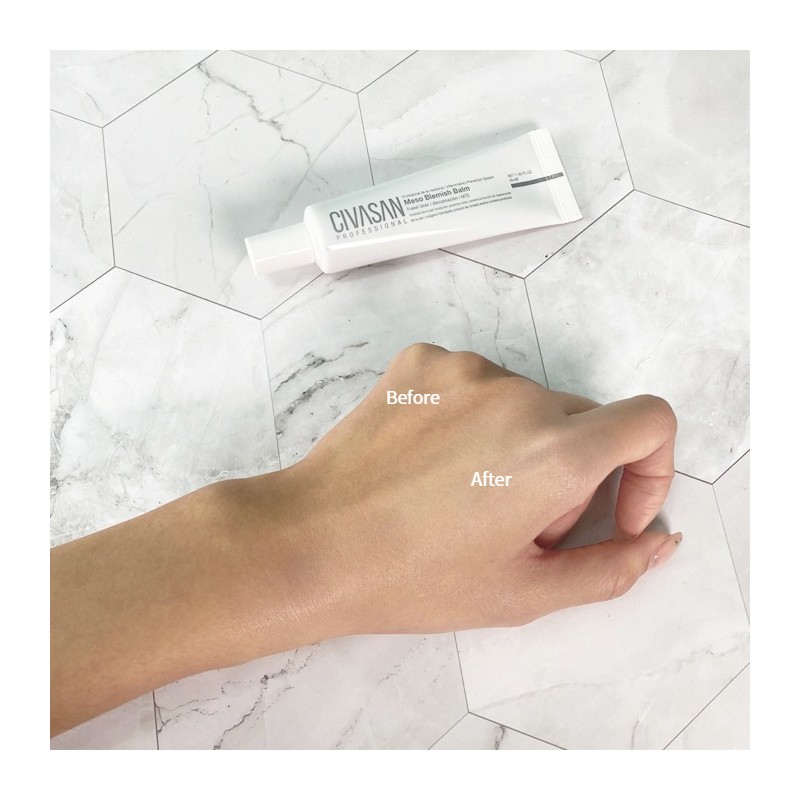 Shivasan Meso Blemish Balm Sivasan BB Meso Blemish Balm 35ml