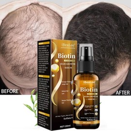 탈모 치료/머릿결개선/모발 강인화, 20ml, 1개 Hair Loss Treatment / Hair Improvement / Strengthening Hair, 20ml, 1 unit