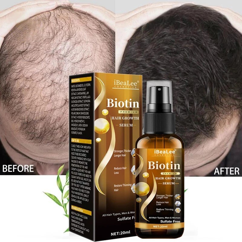 탈모 치료/머릿결개선/모발 강인화, 20ml, 1개 Hair Loss Treatment / Hair