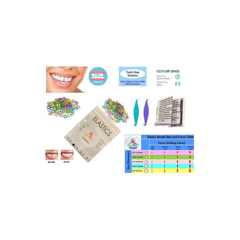 Dental Ortho Elastic Rubber Bands Mixed Colors 100 Pack Teeth