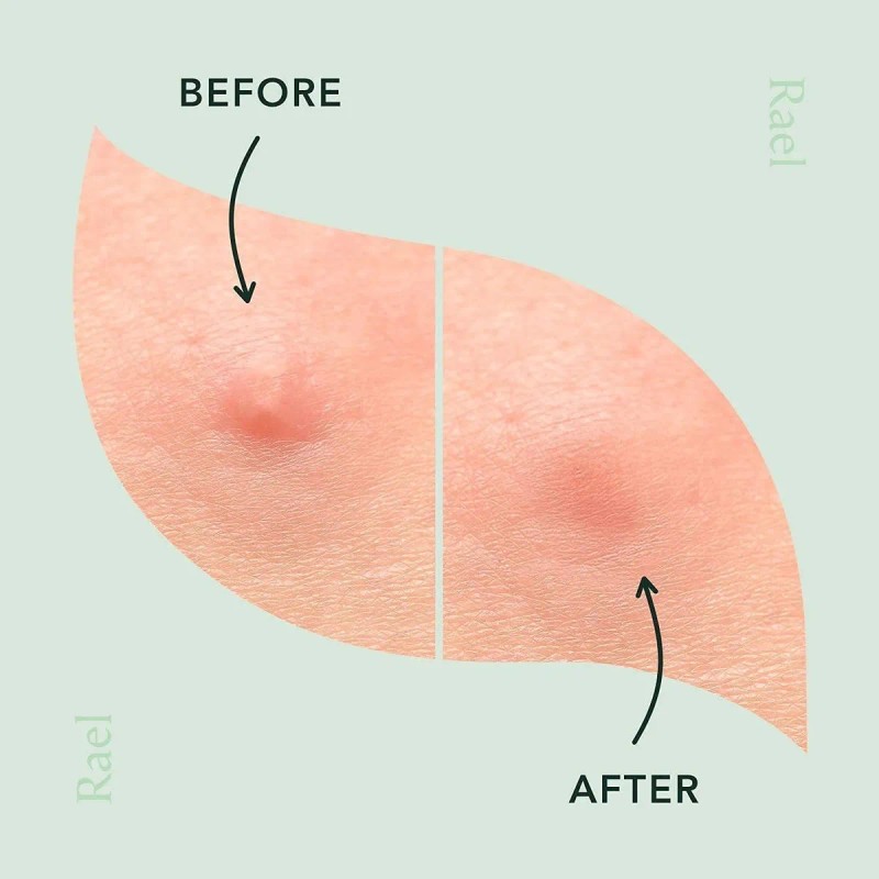 Rael Miracle Microcrystal Spot Cover - Parches Hidrocoloide,