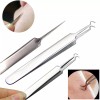 BEAUTÉ GALLERIA Curved Tweezers Blackhead Remover Pimple Extractor Popper Acne