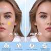 🔥 240pzs mascarillas estrella para el acne espinillas granos—iynskinix® Vitaminas