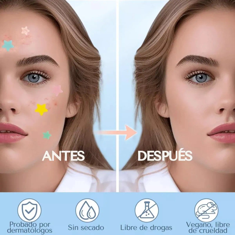 🔥 240pzs mascarillas estrella para el acne espinillas granos—iynskinix® Vitaminas