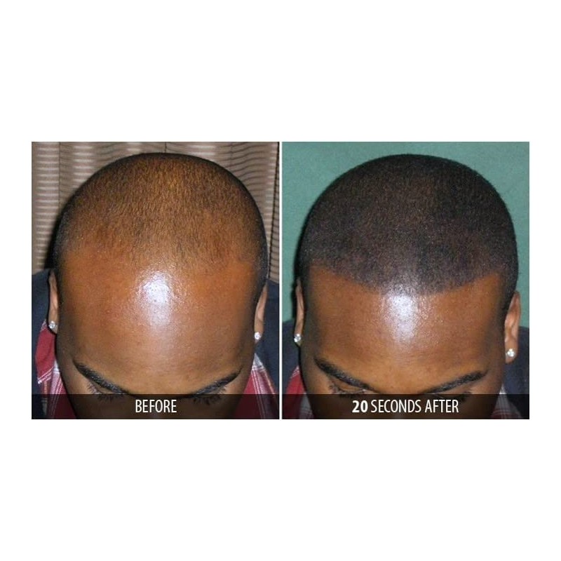 Dr. Yates MD Keratin Fiber Hair Enhancer (Medium Brown)