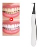 Electric Dental Calculus Remover Portable Oral Calculus Remover Teeth Cleaning