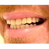 Instant Smile Comfort Fit Flex Teeth - Upper and Lower