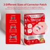 Upgraded Titanium Alloy Ingrown Toenail Corrector with Upgraded 6-Angle Shape,3x
