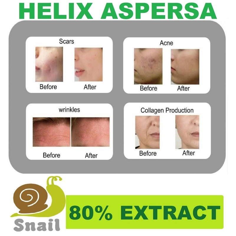 E. 1 Helix Aspersa skin care Snail Gel Baba de
