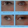 Eye Line Eraser Cream - Anti Aging Wrinkle Treatment for