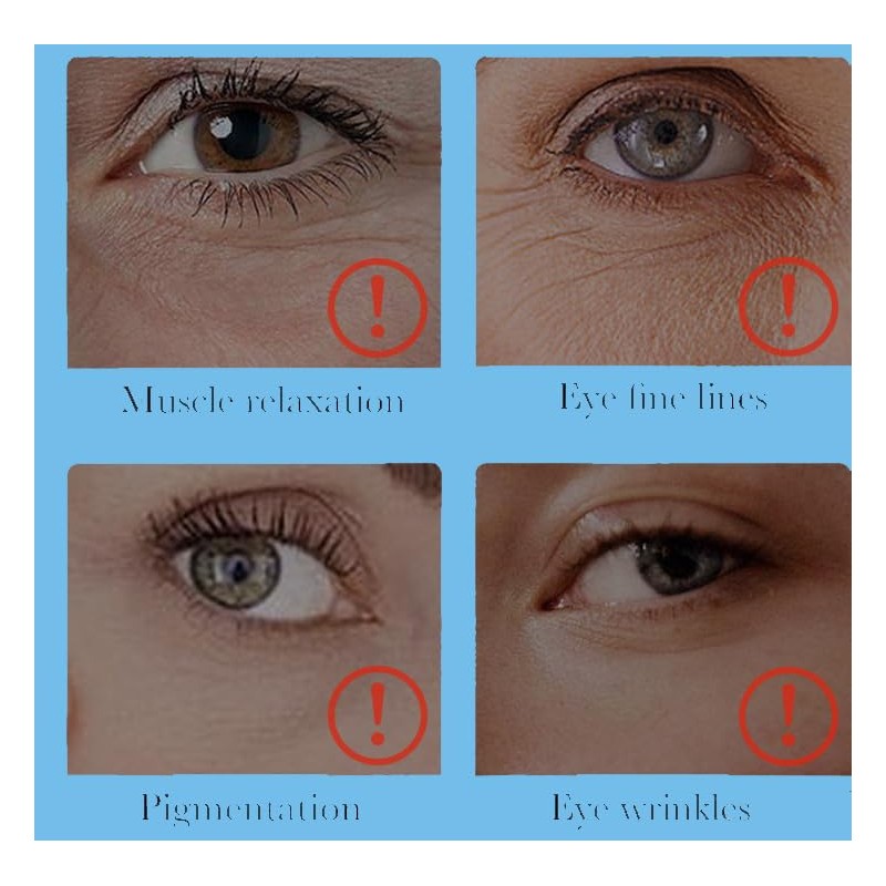 Eye Line Eraser Cream - Anti Aging Wrinkle Treatment for