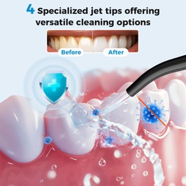 LINKEVAP Water Flosser for Teeth Pick,360ML Rechargeable Travel Oral Irrigator Cleaner,IPX7 Waterproof Daily Dental Care Machine for Home (Black)