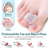 Povihome 10 Pack Clear Toe Spacers, Big Toe Separator (1st/2nd